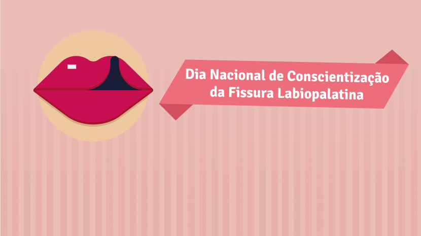 24/06 – Dia Nacional de Conscientização sobre a Fissura Labiopalatina